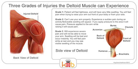 side deltoid tear test|deltoid strain recovery time.